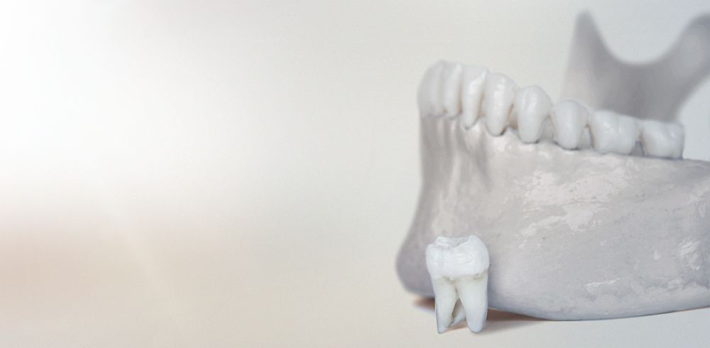 Link zur Seite Fortbildung 2026 - Operative Entfernung der Weisheitszähne