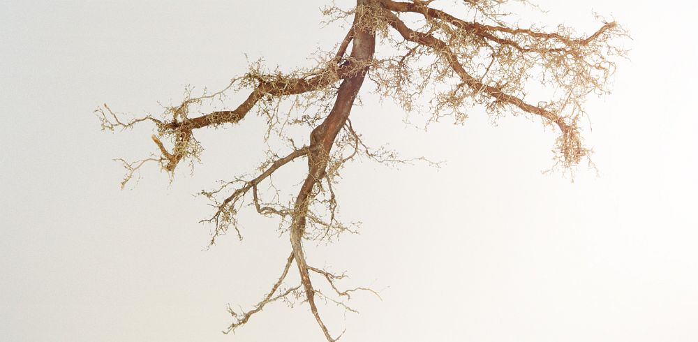 Link zur Seite Fortbildung 2026 - Die Geheimnisse der mikroskopischen Wurzelspitzenresektion